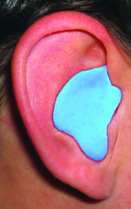 Picture of Radians Diy Custom Molded Earplugs